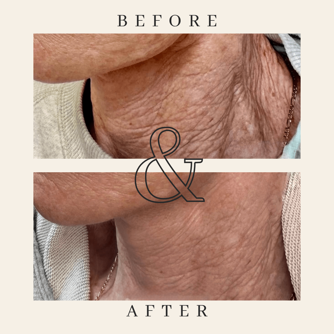 Tighten & Lift Neck Cream