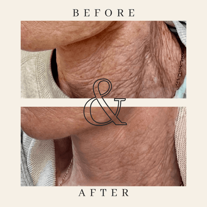 Tighten & Lift Neck Cream